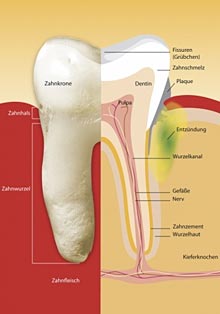 Parodontologie ist die Lehre vom Zahnhalteapparat